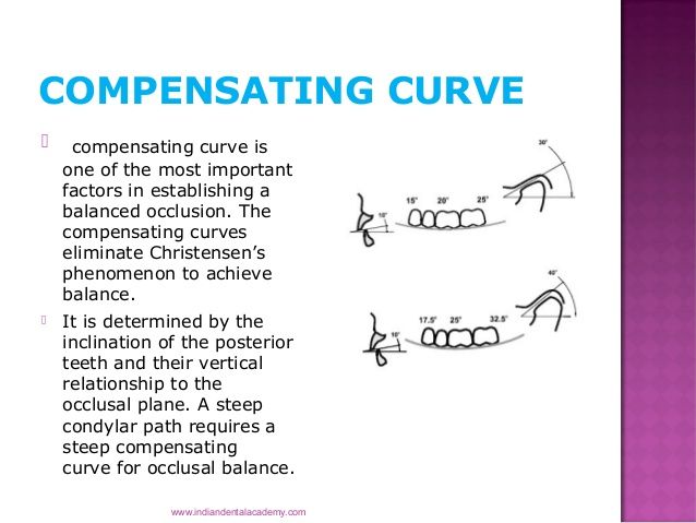 compensating balance